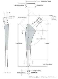 A400 Anteverted Stem Specifications
