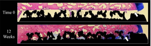 Figure 2: Pictured is a 75μm section view from a weight-bearing Ovine study showing bone ingrowth into the Tesera trabecular structure at 12 weeks