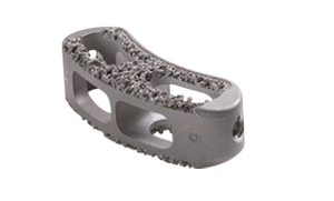 Tesera P Posterior Lumber Interbody Fusion System