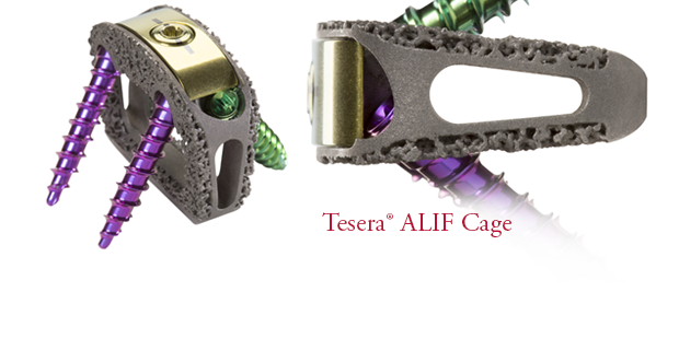 Tesera SA Stand-Alone ALIF Cage System