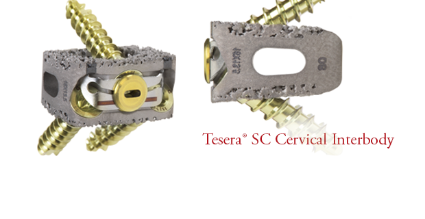 Tesera SC Stand-Alone Cervical  Interbody System